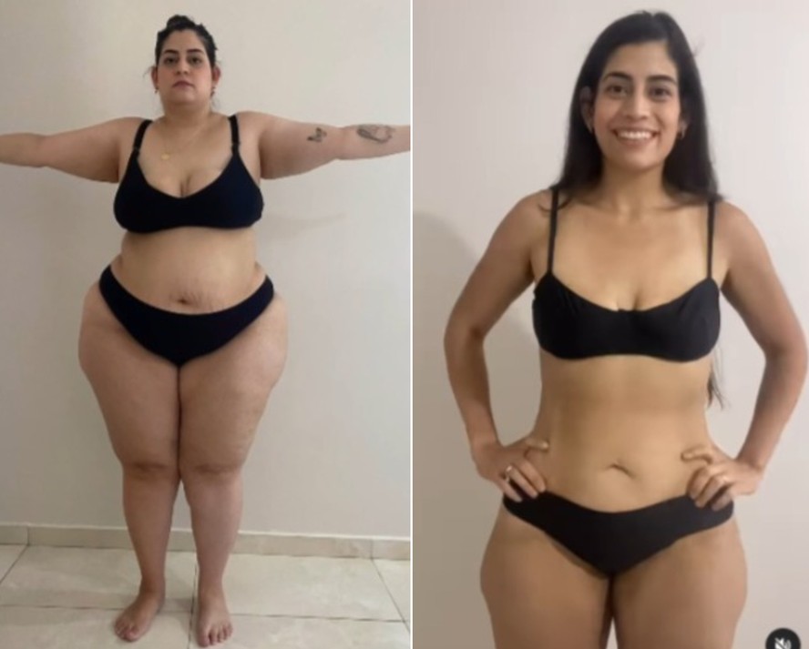 Foto de transformação antes e depois com mudança de hábitos alimentares